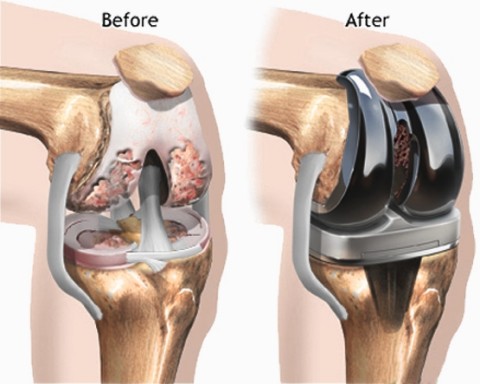 Physiotherapist assessing knee joint movement