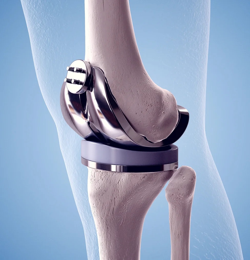 Doctor consulting a patient about knee treatment